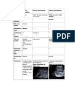 TIPOS DE Ictericia Prehepática