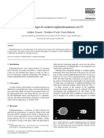 Cephal Hematoma Case Report