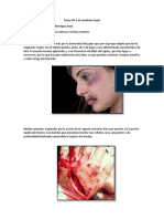 Diferencias entre lesiones contusas y cortantes