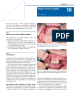 Fragiskos Preprosthetic Surgery. Oral Surgery, 243 279