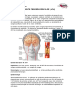 ACV: Causas, Tipos, Síntomas y Tratamiento del Accidente Cerebrovascular