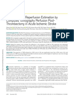 Optimal Tissue Reperfusion Estimation by Computed Tomography Perfusion Post Thrombectomy in Acute Ischemic Stroke