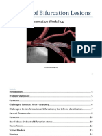 Stenting Bifurcation - Published