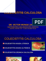 Colecistitis Calculosa
