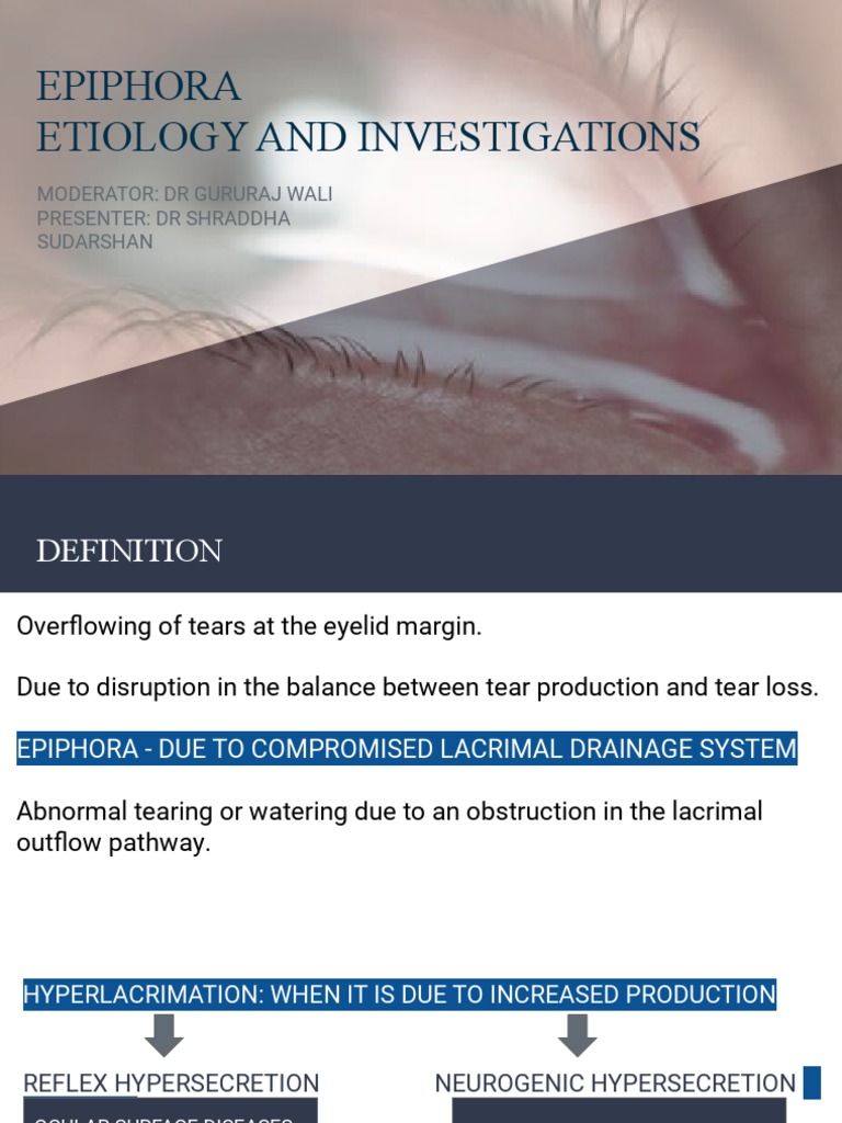 Epiphora PDF Clinical Medicine Medical Specialties