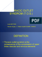 Thoracic Outlet Syndrom (Tos)