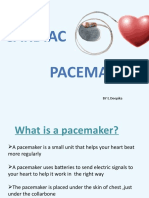 Cardiac Pacemaker: BY E.Deepika