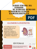 Glomerulonefritis Postestreptococica