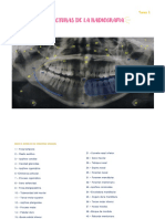 Estructuras de la radiografía dental