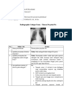 Tugas Kritisi&Evaluasi Radiografi Thorax_Risna Putri A_220177_2D