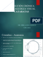 Cataratas y disminución crónica de la agudeza visual