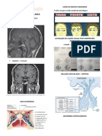 Endocrinologia: Neuroendocrinologia, Hipófise, Hiperprolactinemia e Prolactinoma