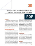 Fibrosis pulmonar idiopática