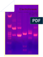 Electroforesis LuciaGallardo