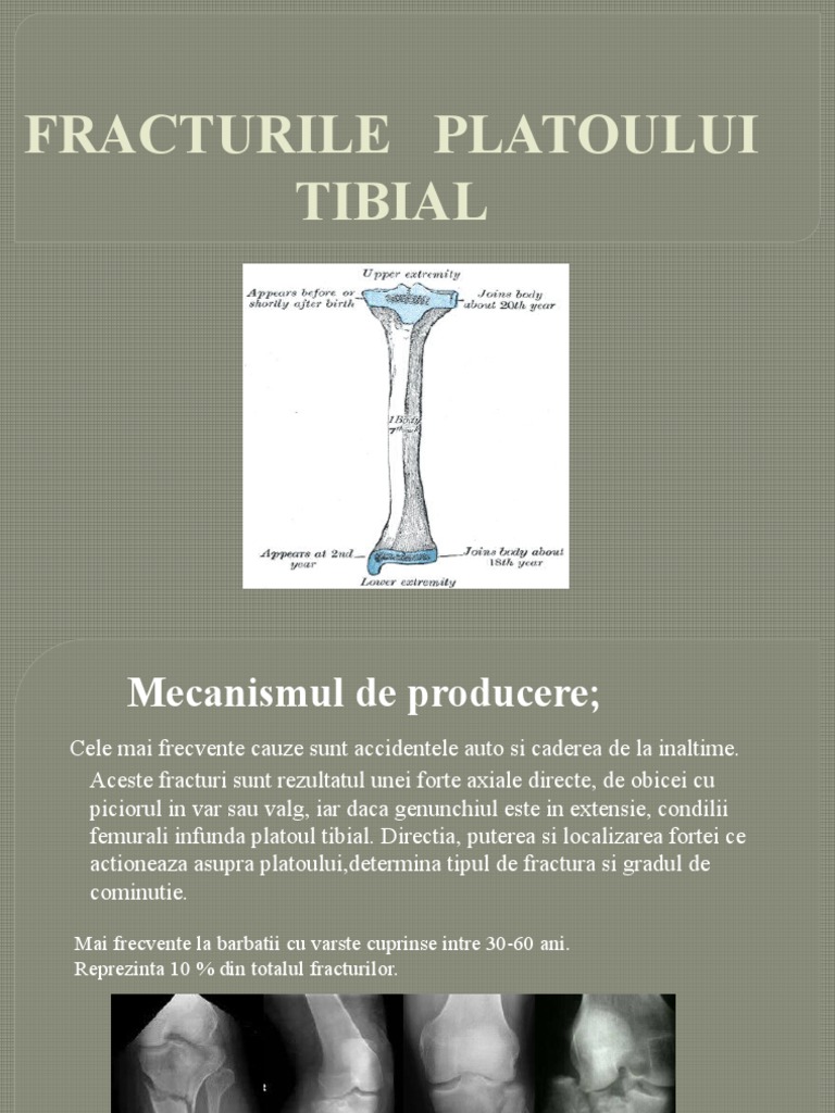 Platou Tibial FR Diaf Oase Gamba GR 33 | PDF