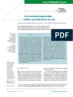 Carcinoma Hepatocelular Sarcomatoide