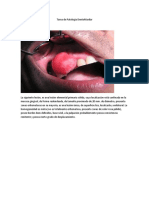 Tarea de Patología DentoMaxilar