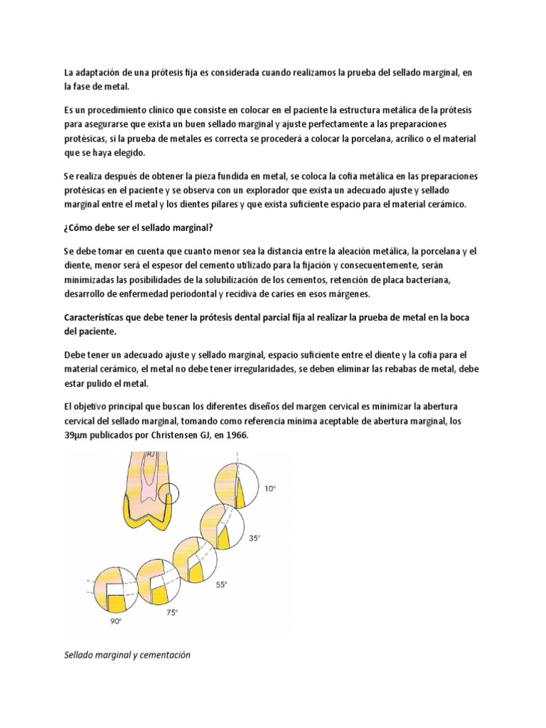 Sellado y ajuste marginal en prótesis fijas | PDF | Dentadura postiza ...