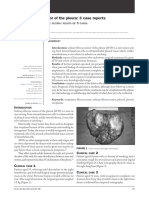 Solitary Fibrous Tumor of The Pleura: 3 Case Reports: Image in Medicine