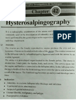 Hyesterosalpingography by JBD