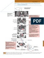 Posterior Column-Medial Lemniscus System in Clinical Orientation: Representative Lesions and Deficits