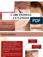 6. Carcinomas cutaneos