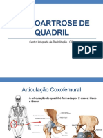 Osteoartrose de Quadril
