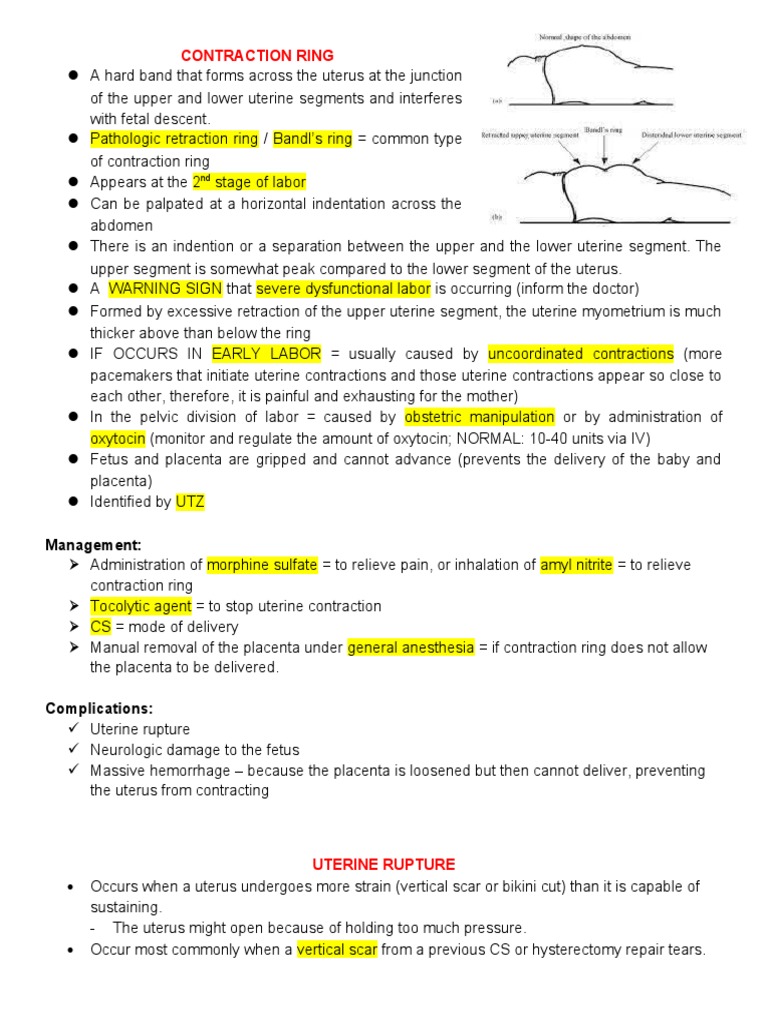 Understanding Bandl's Retraction Ring | PDF | Childbirth | Uterus