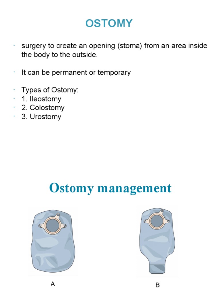 Ostomy | Download Free PDF | Gastroenterology | Health Sciences