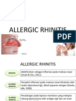 Allergic Rhinitis