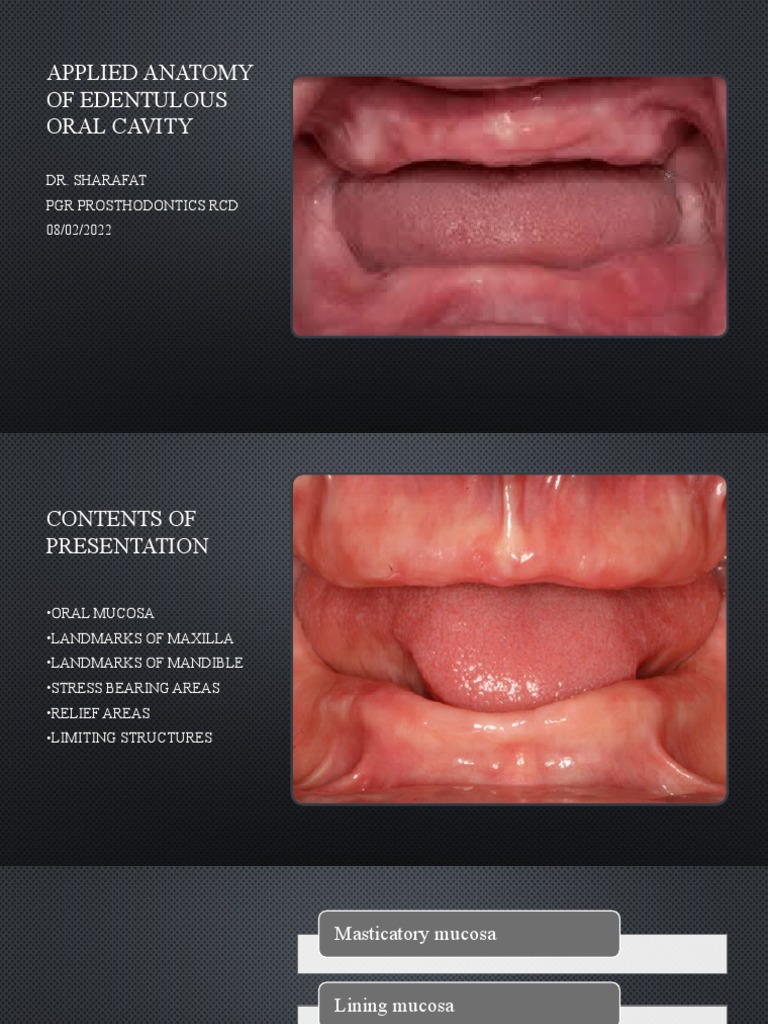 Applied Anatomy of Edentulous Oral Cavity PDF Dentistry Branches