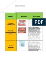 Ferulas Cuadro Comparativo