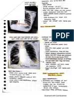 Radiografi kelainan paru