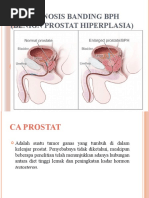 Download Diagnosis Banding BPH Ppt by Jessica Saman SN55772427 doc pdf