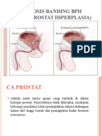 Diagnosis Banding BPH