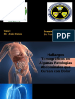 Patologias Quirurgicas Abdominales Por Imagen