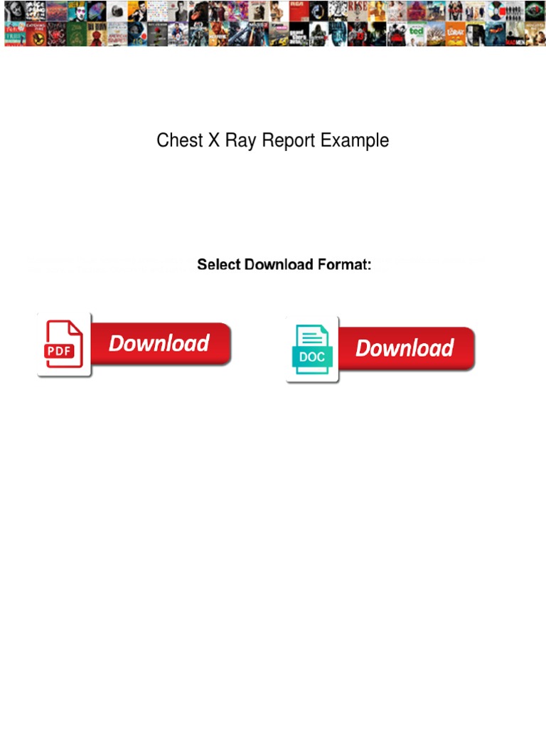 Chest X Ray Report Example PDF Radiography Radiology