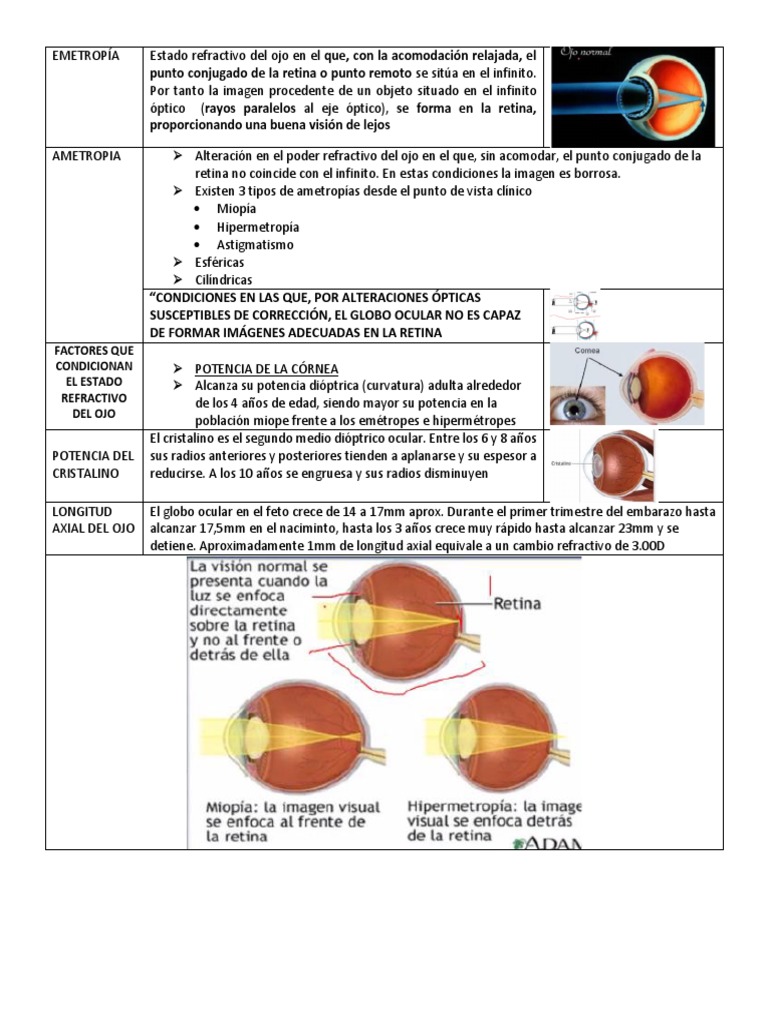 EMETROPÍA PDF Ojo humano Miopía
