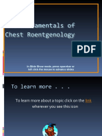 The Fundamentals of Chest Roentgenology: in Slide Show Mode, Press Spacebar or Left Click The Mouse To Advance Slides