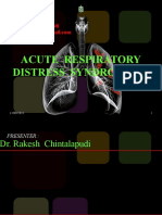 Acute Respiratory Distress Syndrome: DR - Rakesh Chintalapudi