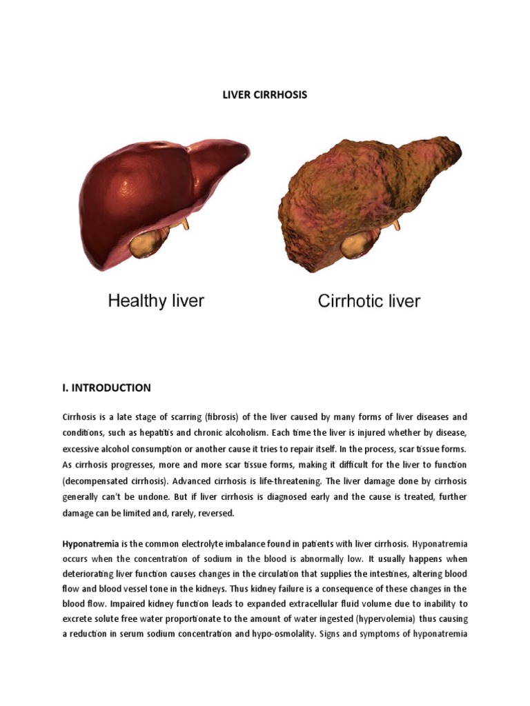 Case Study Liver Cirrhosis PDF Cirrhosis Liver