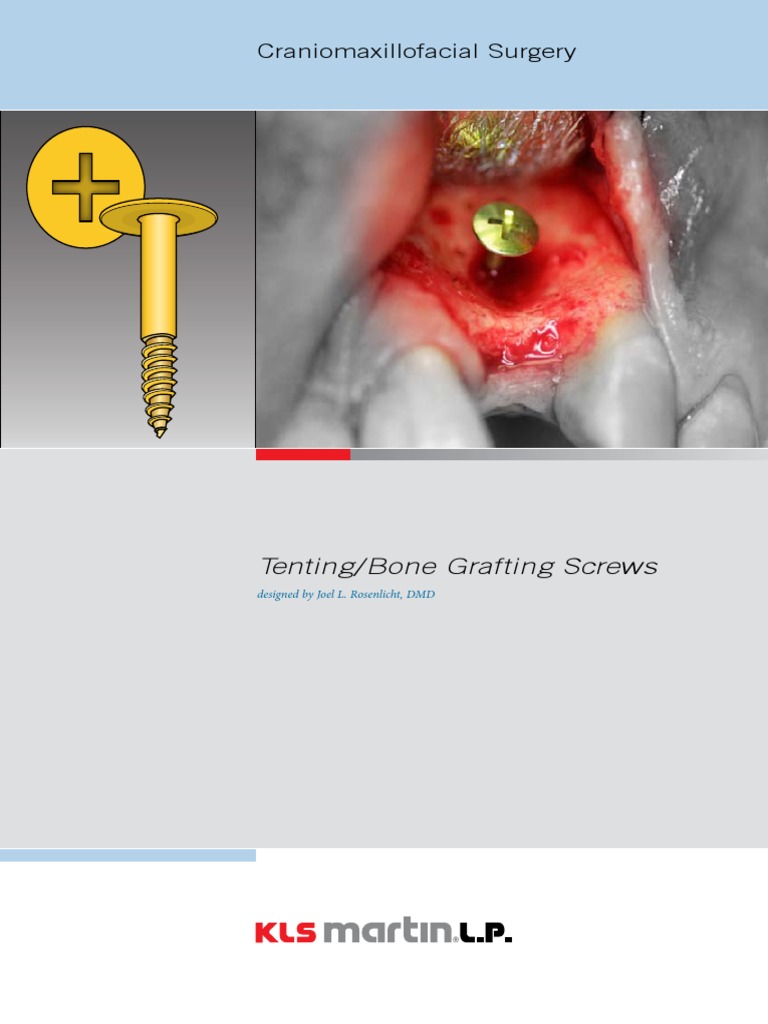 Tenting and Bone Graft Screw PDF Bone Dental Implant