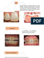 Esmalte dental: Formación, estructura y enfermedades