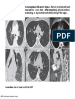 Romain Muller Et Al. Eur Respir Rev 2021 30:210078: ©2021 by European Respiratory Society