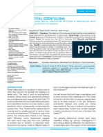 Partial Edentulism : Exploring Partial Edentulism Patterns in Mandibular Arch Among Patients of Karachi