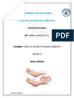 Edema