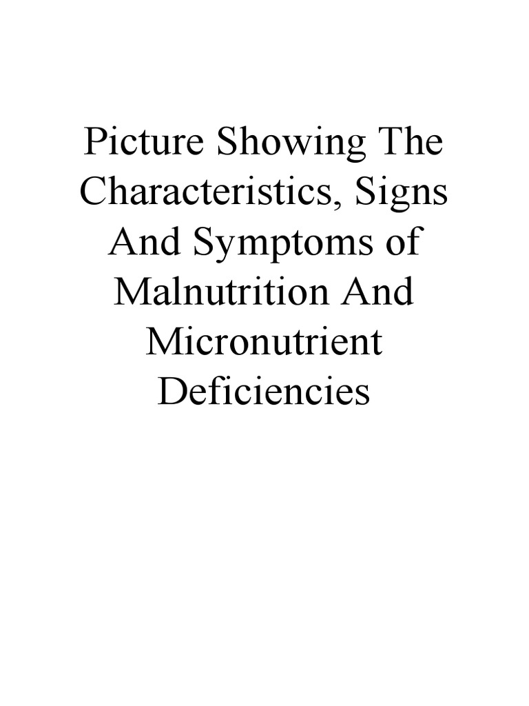 Picture Showing The Characteristics, Signs and Symptoms of Malnutrition ...