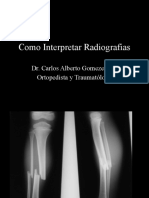 Cómo interpretar radiografías de forma sistemática