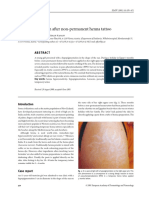 Hypopigmentation After Non-Permanent Henna Tattoo: Case Report