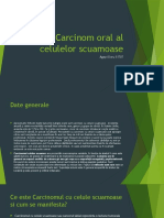 Carcinom celule scuamoase